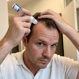 Aplicare ser roll-on pe scalp